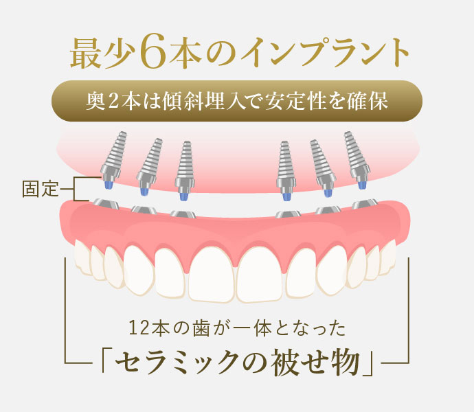 オールオン6の実績と仕組み