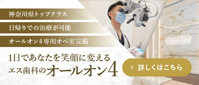 エス歯科オールオン4治療専門サイト