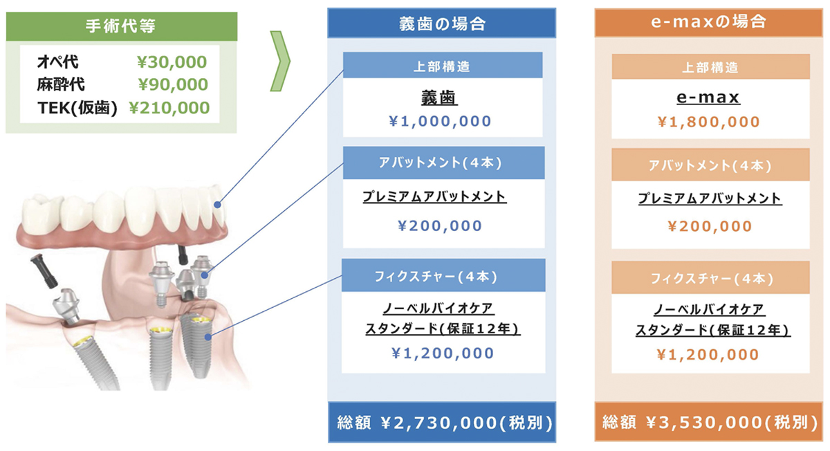 オールオン4見積もり例