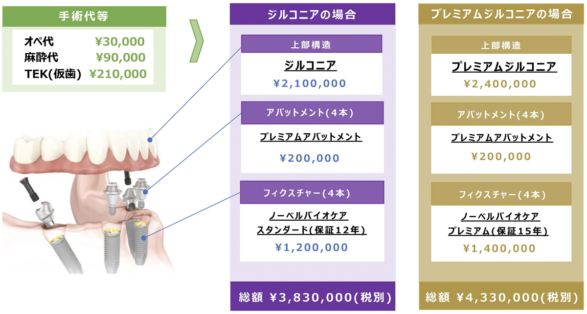 オールオン4見積もり例