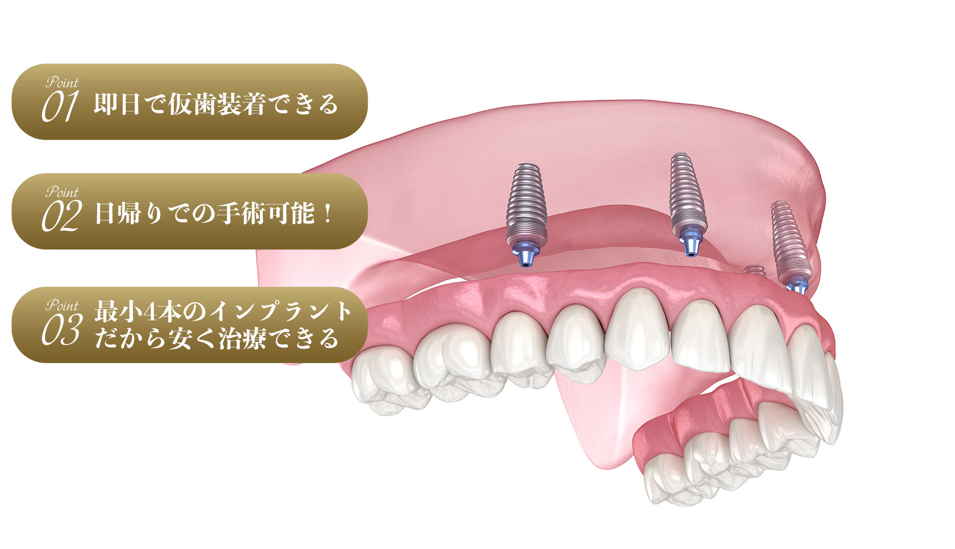 オールオン4